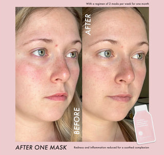 Strawberries & Cream Soothing Mask
